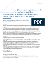 Mixed Infections (Mucormycosis, Actinomycosis and Candidiasis Leading To Maxillary Osteomyelitis in A Diabetic Mellitus Patient in Post COVID Phase