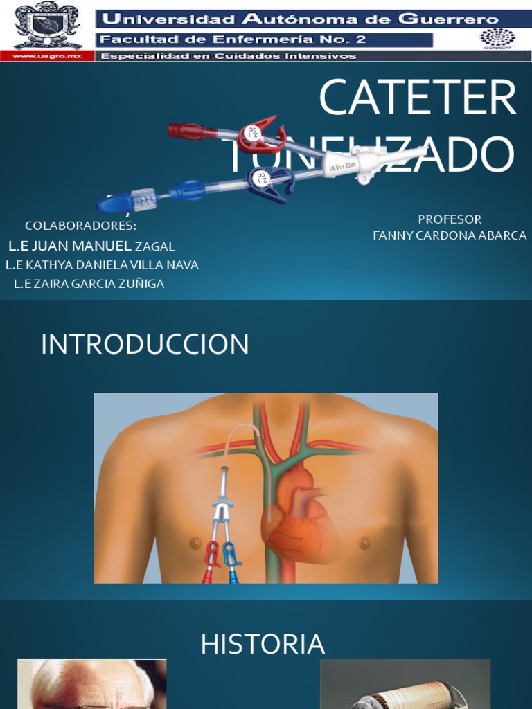Cateterismo: Características, Funciones Y Tipos – LDEPE