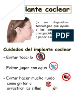 infografia implante coclear