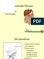 Diverticular Disease: - Diverticulosis - Diverticulitis