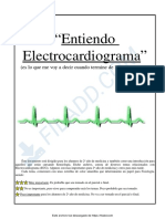 Entiendo ECG