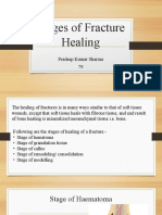 Stages of Fracture Healing