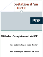 Anomalies Du RCF