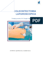 Colecistectomia Laparoscopica.