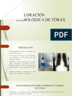 Exploración Radiológica de Tórax