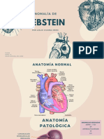 Anomalía de Ebstein Presentacion