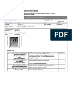 Radiologi Gigi Klinik Abses Periapikal