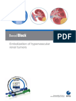 Bead Block™ Embolization of hypervascular renal tumors