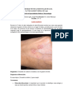 Dermatitis de Contacto