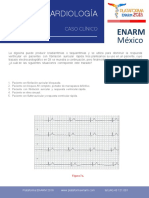 Fibrilación auricular con bloqueo AV completo