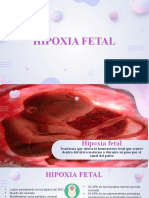 Hipoxia Fetal