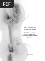 Lupus