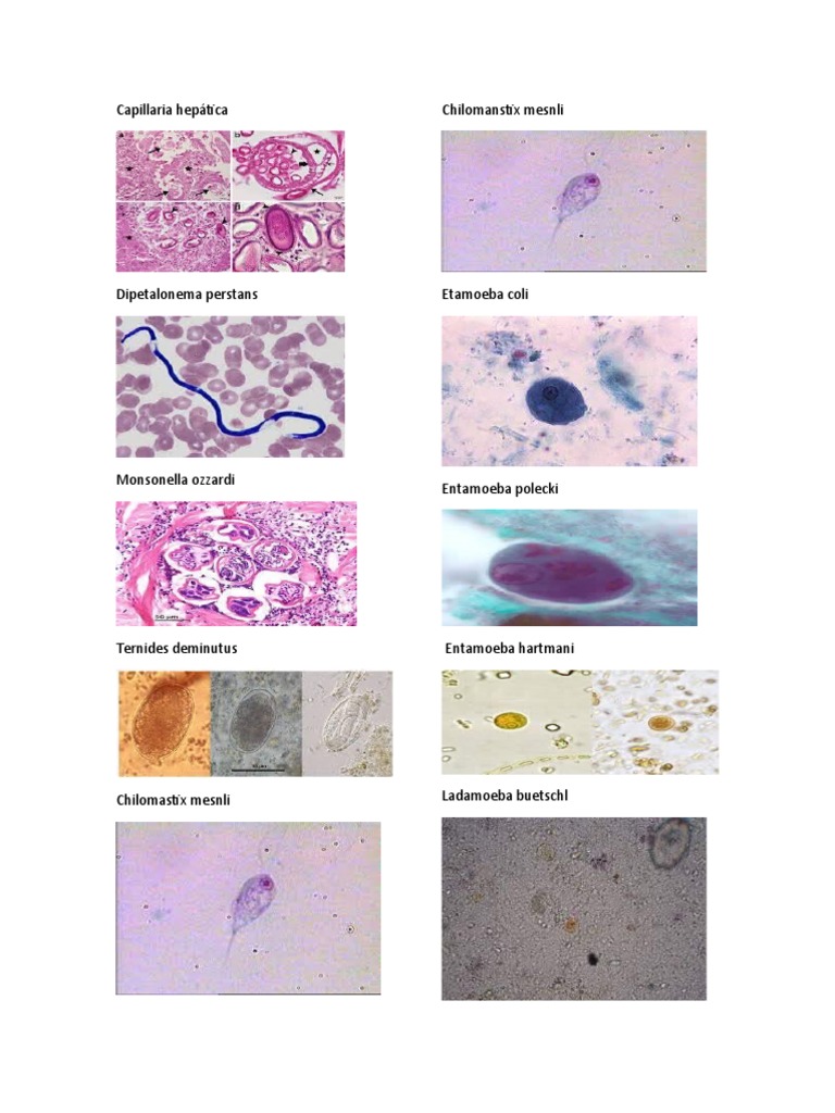 Capillaria Hepática | PDF