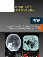 Hipertension Endocraneana