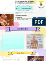 Diapositibas Tuberculosis