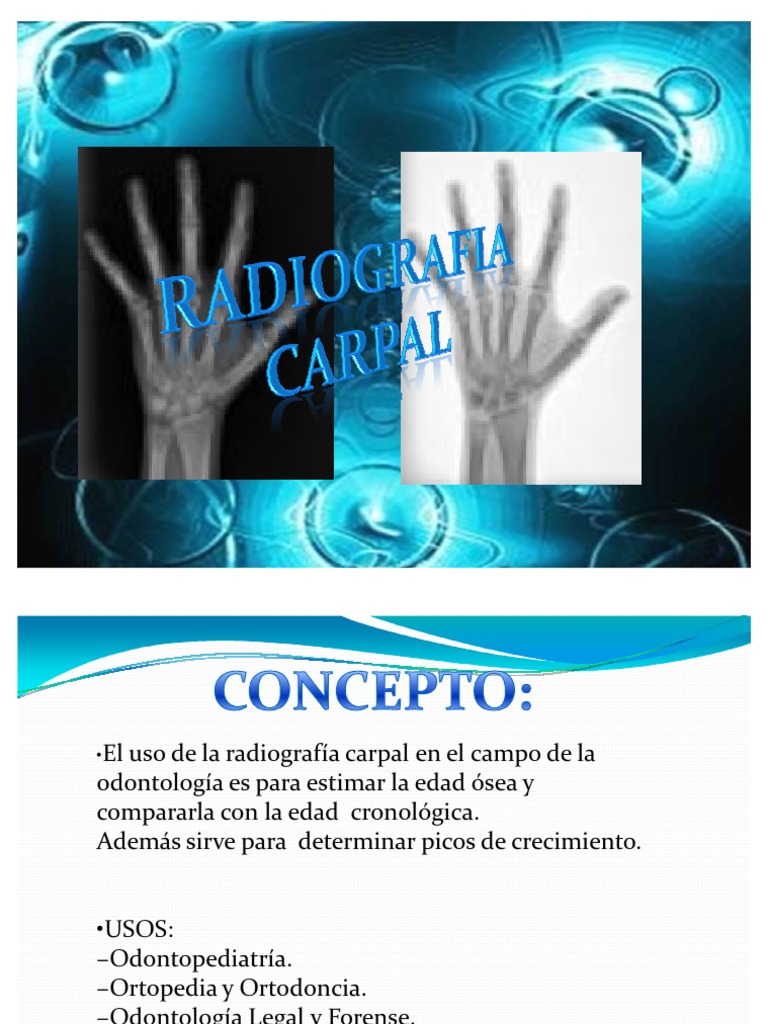 Radiografía del Carpo en Niños y Adultos | PDF | Mano | Sistema ...