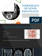 Tomografia de Senos Paransales