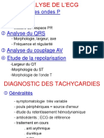 Analyse de L'ecg