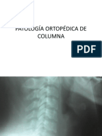Patología Ortopédica de Columna