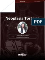 Neoplasia Torácica: Larissa Prado Meira