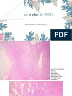 MPNST Pleiomorphic MR