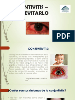 Conjuntivitis Como Evitarlo