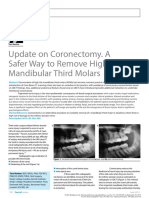2017 Update On Coronectomy. A Safer Way To Remove High Risk Mandibular Third Molars