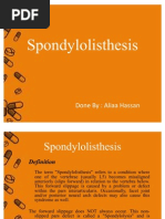 Download 21 - Spondylolisthesis - D3 by Mohamed Magdy El Meligie SN58330910 doc pdf