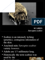 Itchy Infestation: The Causes and Treatment of Scabies
