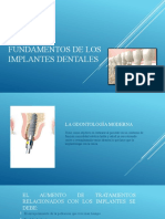 Fundamentos implantes dentales