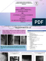 Fracturas Vertebrales Por Osteoporosis