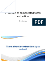 Principles of Extraction of Complicated Teeth