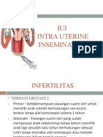 Inseminasi