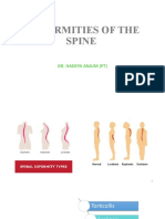 Deformities of The Spine
