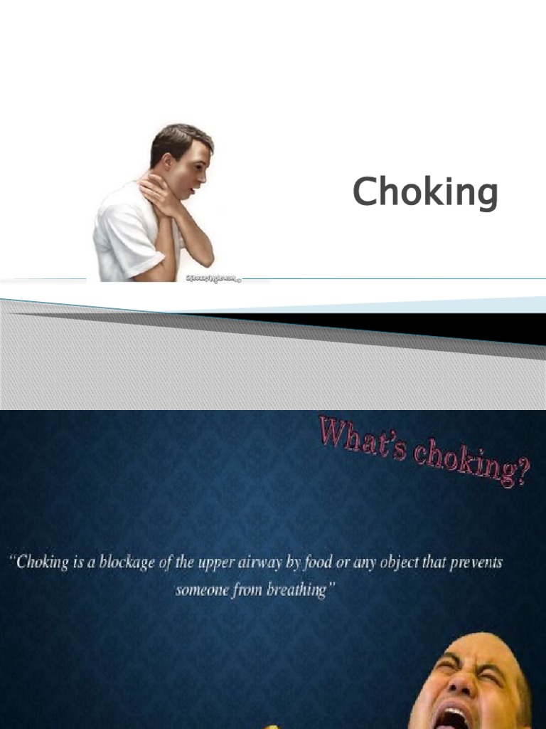 Choking PDF Clinical Medicine Medical Emergencies