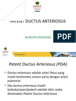 Patent Ductus Arteriosus