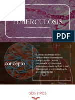 3.4.4 Tuberculosis