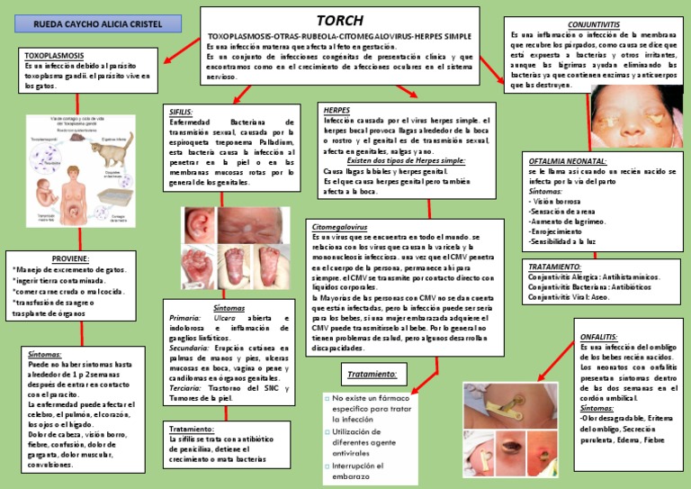 Torch PDF Herpes Simple Infección