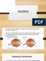 Myopia