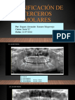 Clasificación de Terceros Molares Práctica