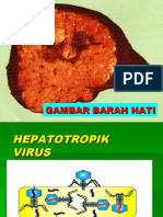 5 Hepatitis B, C & D