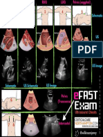 eFAST Ultrasound Exam Schematics and Images