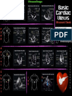 Basic Cardiac Views