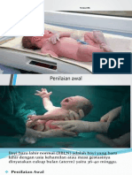 APGAR Skor Penilaian Bayi Baru Lahir