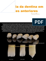 Anatomia+da+dentina+em+dentes+anteriores (1)