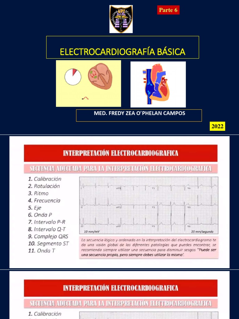 Calculating the Electrical Axis of the Heart Methods and Examples