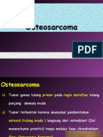 295484760 Osteosarcoma Ppt