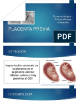 placenta previa Esther rivera