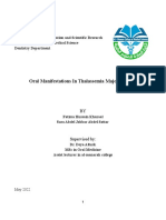 Oral Manifestations in Thalassemia Major Patients