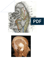 Parotid A